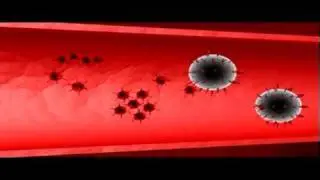 HIV destroys helper T-cells | Biology | Anatomy | Immunology
