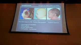 Thesis Research Presentation - MBI 2018