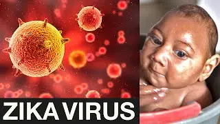 The Zika Outbreak Explained
