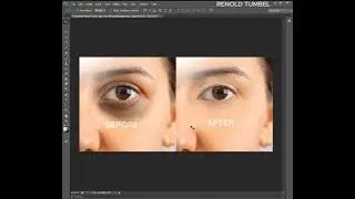 How to remove dark eye circles in Photoshop | PHOTOSHOP TUTORIAL