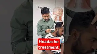 Headache treatment by dr harish grover 