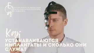 Экспертное мнение на вопросы по имплантации от хирурга-имплантолога Сорокина Егора Андреевича
