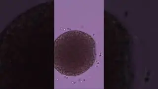 Sea urchin fertilization 3 #shorts