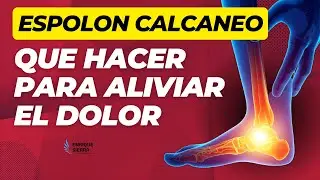 ESPOLÓN CALCÁNEO: QUE HACER PARA ALIVIAR DOLOR 👣