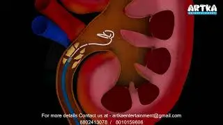 Medical 3d Animation