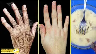 Eliminar Las Arrugas En Las Manos Y Tener Manos Suaves Con Estos 2 Ingredientes