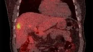 Man eats leftover pasta and this happens