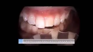 Базовое руководство по использованию Estelite Asteria русская озвучка