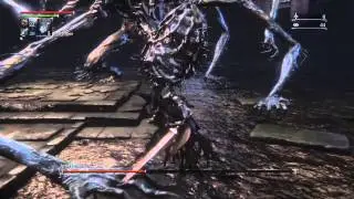 Bloodborne - Greater Amygdala