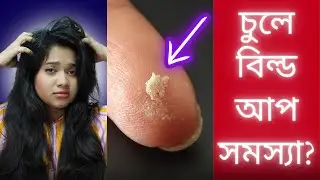 🤔 শ্যাম্পু করলেও চুল পরিষ্কার হয় না? চুলের বিল্ড আপ সমস্যার সমাধান! Hair Buildup Solution