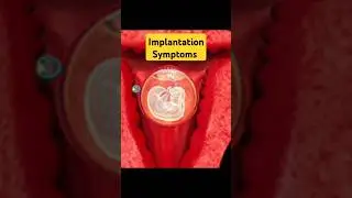 Very first Pregnancy Symptom #earlypregnancy #pregnancysymptomsinhindi #implantation #pregnancy