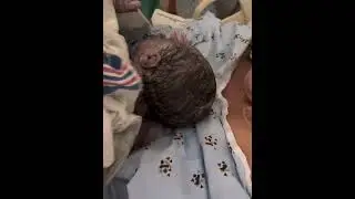 Birth Story 
