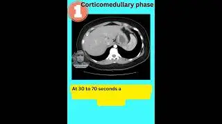 1. Corticomedullary phase of CECT KUB. #youtubeshorts #trending #video #viral #neet #study
