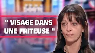Visage BRÛLÉ et DÉFIGURÉ : son peeling s'est transformé en CHAOS I SANS AUCUN DOUTE I S6/S7EP32.1