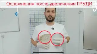 Последствия увеличения груди.