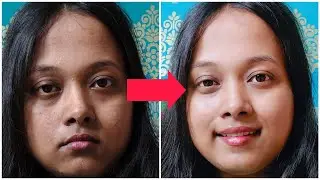 সানট্যান দূর করার এর থেকে সহজ পদ্ধতি হতে পারে না!  sun tan in just 2 mins ✨