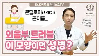 외음부 트러블! '이 모양'이면 '성병'👿 | 곤지름,콘딜로마(사마귀),헤르페스 2탄