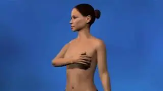 Augmentation mammaire par implants: l'opération expliquée en vidéo