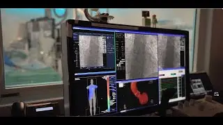 Dose Tracking System (DTS) customer testimonial – Waikato Hospital user experience