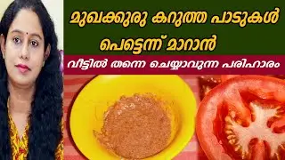 മുഖക്കുരു കറുത്ത പാടുകൾ പെട്ടെന്ന് മാറാന്‍ Cumin Seed Face Pack For Pimples
