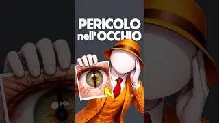 Quest’UOMO HA una LINEA NERA sull’OCCHIO e VA dal MEDICO!😱👀