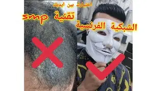 الشبكية الفرنسية افضل حل للصلع الفوري مش مستاهلة قناع ! والتحذير من تقنية smp الفاشلة وعيوبها !