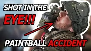 SHOT IN THE EYE - PAINTBALL ACCIDENT - OMG!