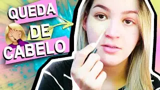 PRIMEIRO mês DEPOIS do ROACUTAN | Maquia e Fala