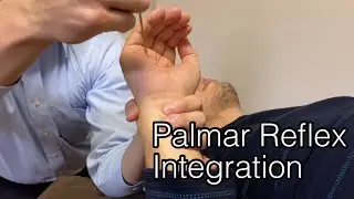 Reflex treatment for palmar reflex