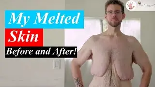 Weight Loss ~ They Refuse to Hide Their Loose Skin ~ Part 3! ~ Body Bizarre