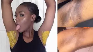 HOW TO LIGHTEN DARK UNDERARMS NATURALLY & FAST IN ONE DAY!!
