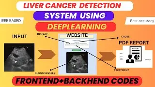 Liver Cancer Detection Using Ultrasound Images |Deep Learning IEEE Final Year Project with Full Code