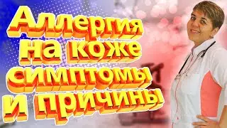 Аллергия на коже: Всё, что вы должны знать❗️