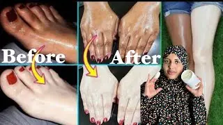 whitening cream/Qasqas o 20$ ah ￼only 7 Days kugu cadeeynayo Waa 100% //whitening cream  #safabeauty