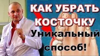 Как убрать косточки на ногах.  Удивительный народный метод