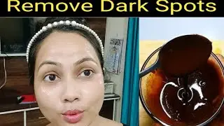 Aloe vera gel for skin whitening / Aloe vera face pack / Aloe vera facial at home / Alovera facial