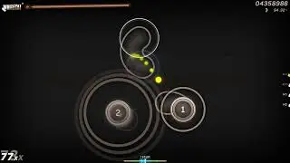 I broke my hand while playing osu!...