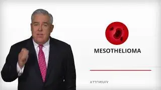 Questions About Mesothelioma? We've Got Answers (Free Downloadable Book)