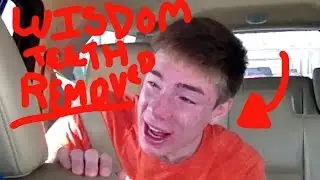 Getting My Wisdom Teeth Removed!