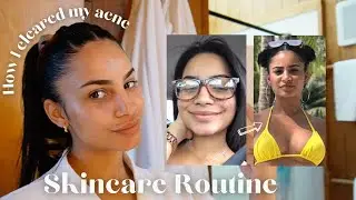 SKINCARE ROUTINE | How I cleared my acne | A very chill vlog | Huge beach house vacation.