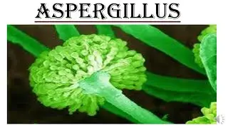 ASPERGILLUS
