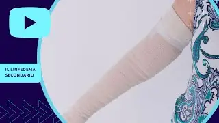 Il linfedema secondario
