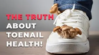 Toenail fungus relief. Why internal treatment matters | Nation Health MD #barefeet
