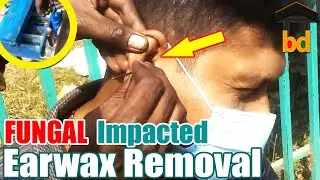 ►Impactful Ear Waxing at Roadside ASMR BD II Dirt & Oily Wax Removal Nicely II Got Refreshed & Paid
