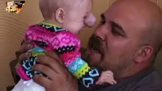 Аномалии тела 3 сезон 1 эп  30 летняя женщина с лицом бабушки  Мозг на лице у младенца