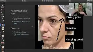 THREADLIFT overview lecture: effective combinations of  Procedures. Dr Larissa Miller Presentation