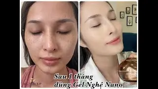 Review Gel Mặt Nạ Ngủ Nghệ Nano Moomery Có Tốt Không ? 0942878757