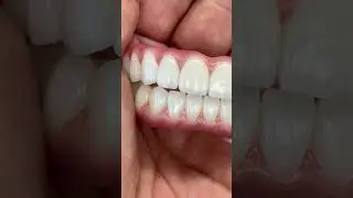Better than Diamonds!