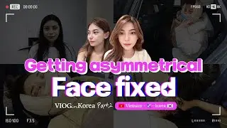 My chin is moved 6mm by genioplasty in korea 🥶 (part 2)