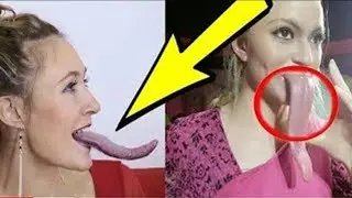 أغرب البشر الذين يمتلكون أعضاء غير طبيعية بالمرة !! #1